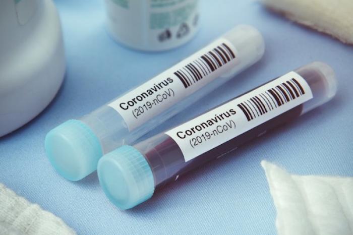 Aprueba Cofepris uso de tres pruebas serolÃ³gicas para Coronavirus