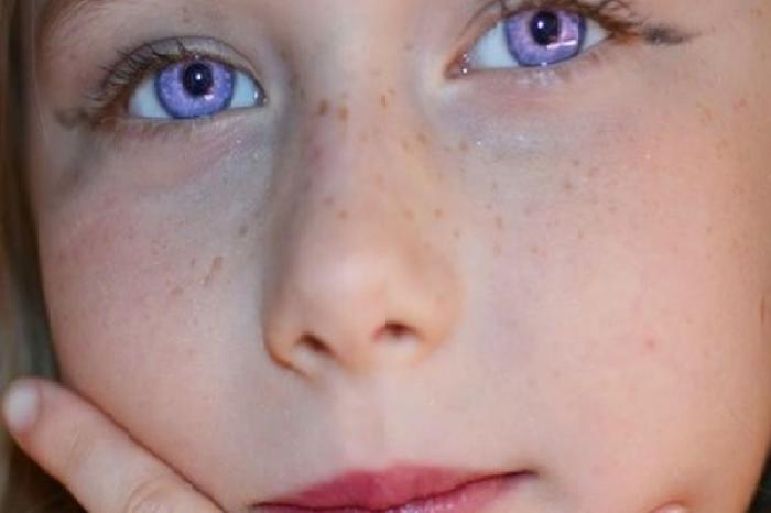 ¿Por qué algunas personas pareciera que tienen los ojos color violeta?