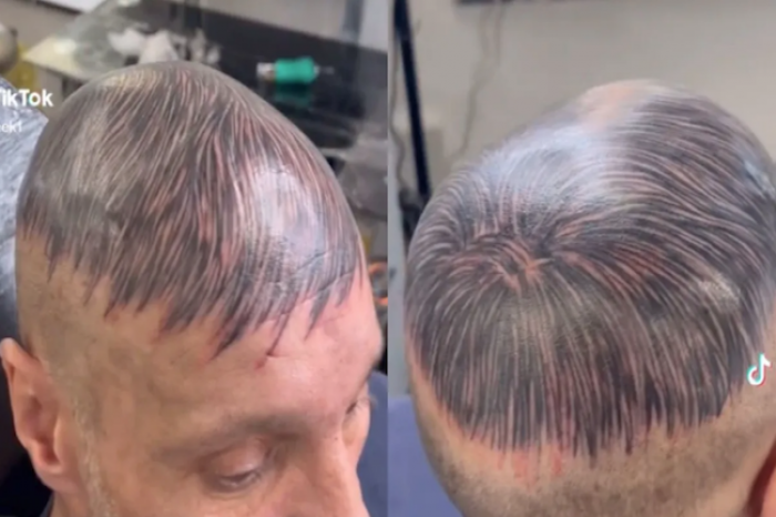 Hombre se tatúa la cabeza para ocultar la calvicie y se hace viral