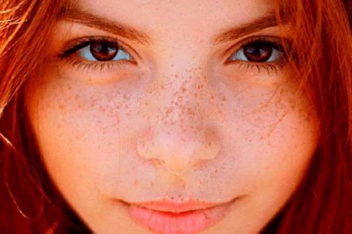 ¿Tatuajes de ¿pecas? La nueva tendencia viral