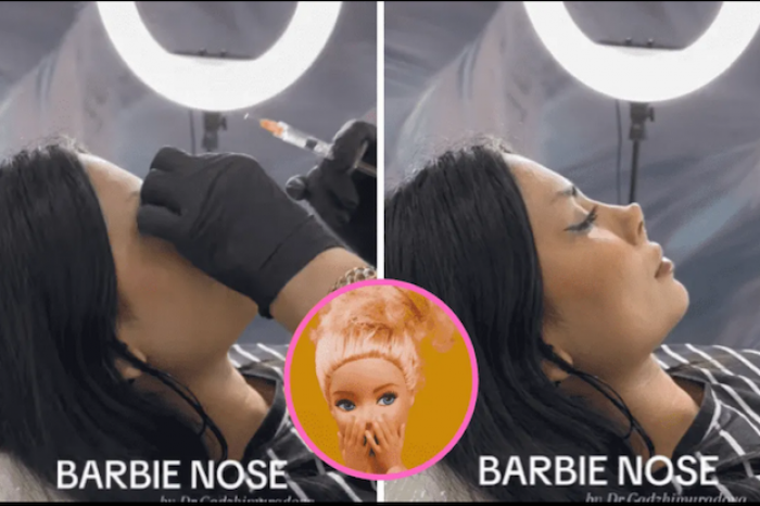 Una mujer muestra cómo quedó tras hacerse rinoplastía para tener la “nariz de Barbie”