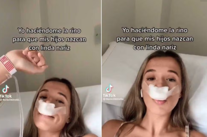 Mujer se somete a rinoplastia para que sus hijos hereden una “nariz bonita