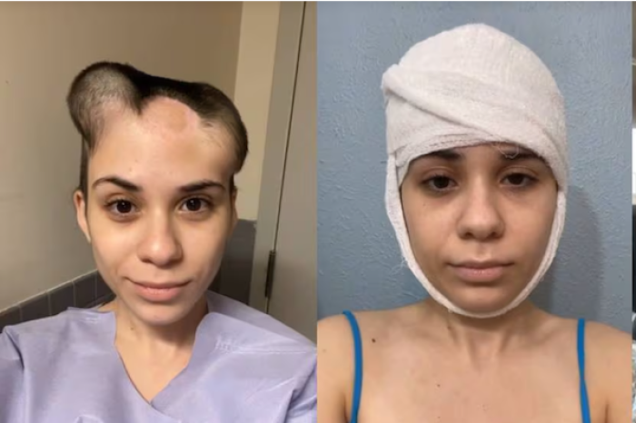 Sobreviviente de cáncer se vuelve viral por su impresionante transformación