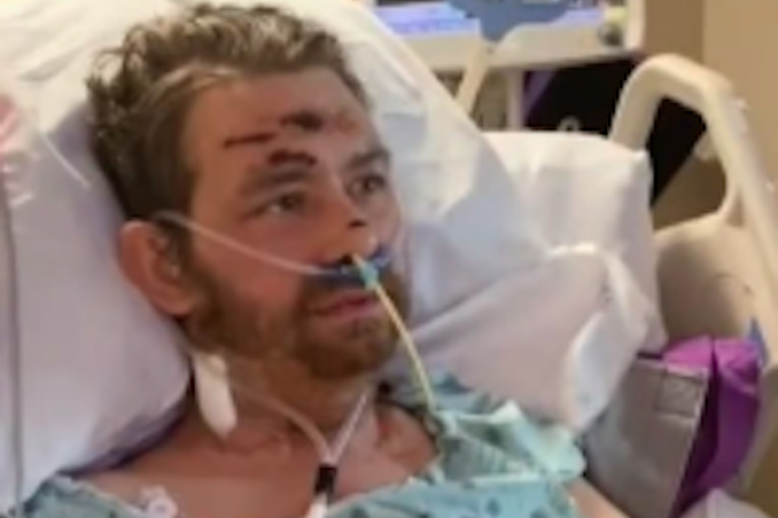  Hombre en Texas se recupera milagrosamente después de padecer sepsis por un pelo encarnado