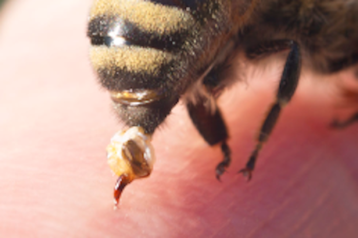 Las picaduras de abejas pueden ser mortales p