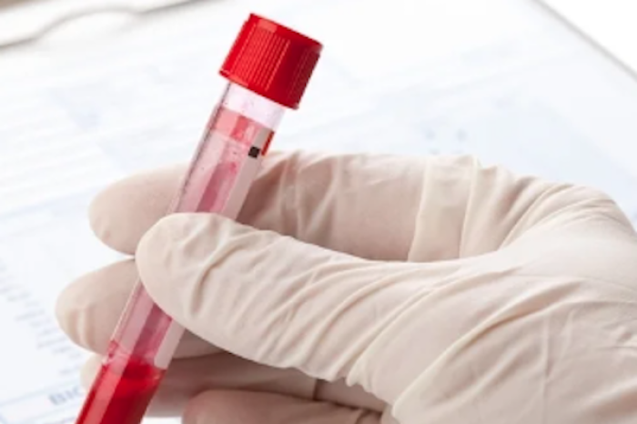 Impacto de la alimentación en las pruebas de sangre: ¿Cuándo debes ayunar?   