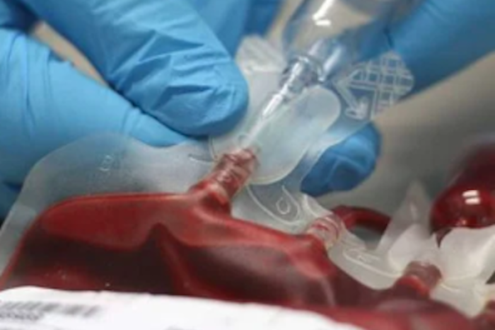 Reino Unido: Escándalo de transfusiones de sangre contaminada expone décadas de negligencia