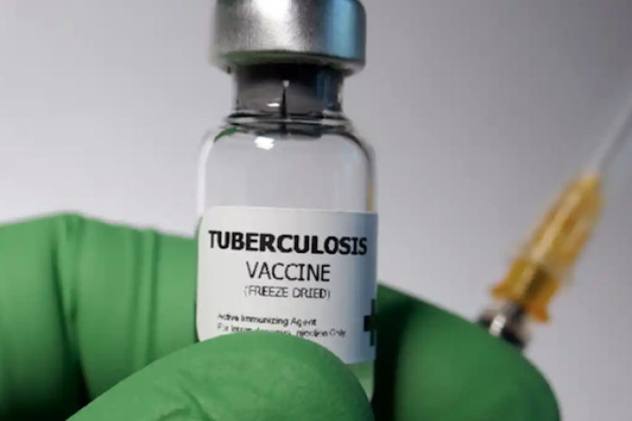 La tuberculosis: un desafío persistente en tiempos de pandemia