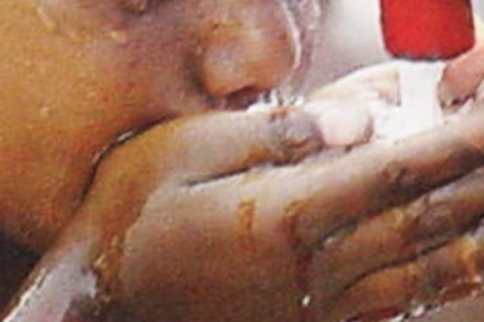 África: Más de 71 mil casos de cólera y m�
