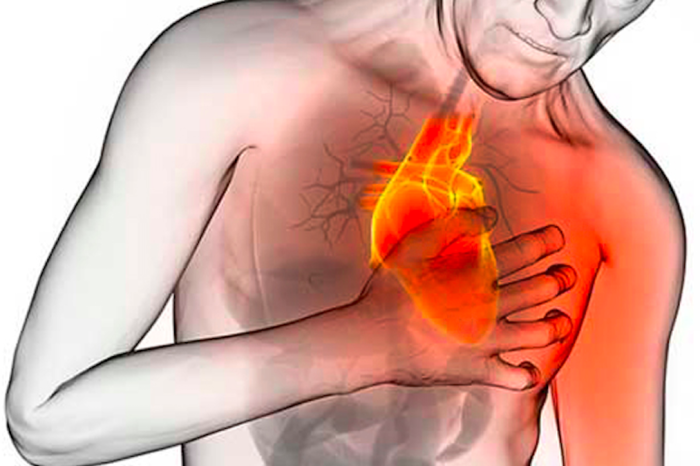 Síndrome del corazón roto