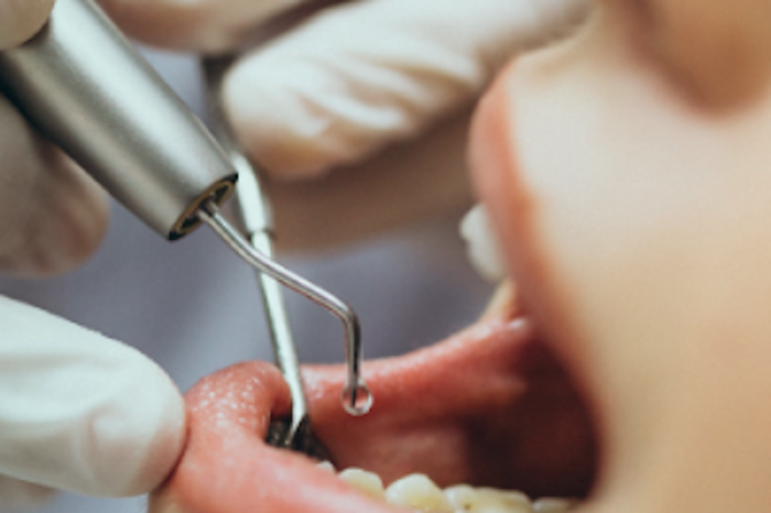 La importancia de la saliva en la prevención