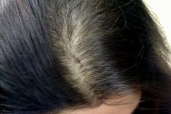 ¿Caída de cabello frecuente? Conoce las causas y consejos para prevenirla