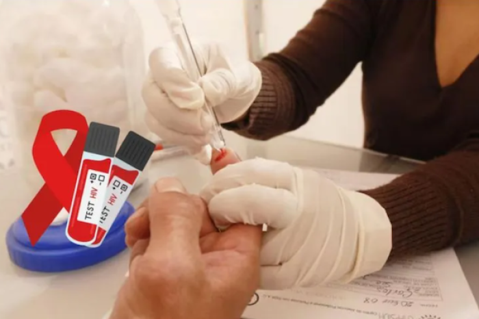 Preocupa incremento de casos de VIH 