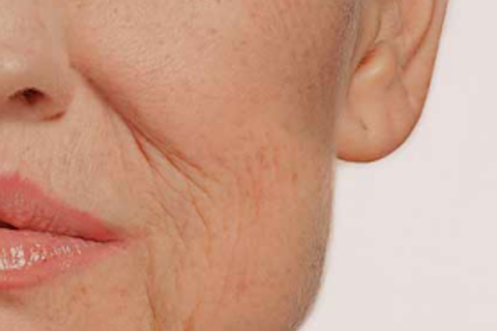 Descubren el verdadero origen físico de las arrugas: no es solo cuestión de edad