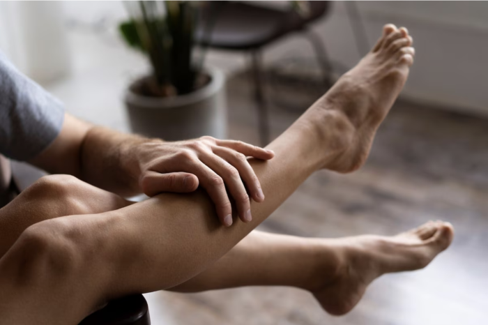 ¿Qué son las várices y por qué aparecen?