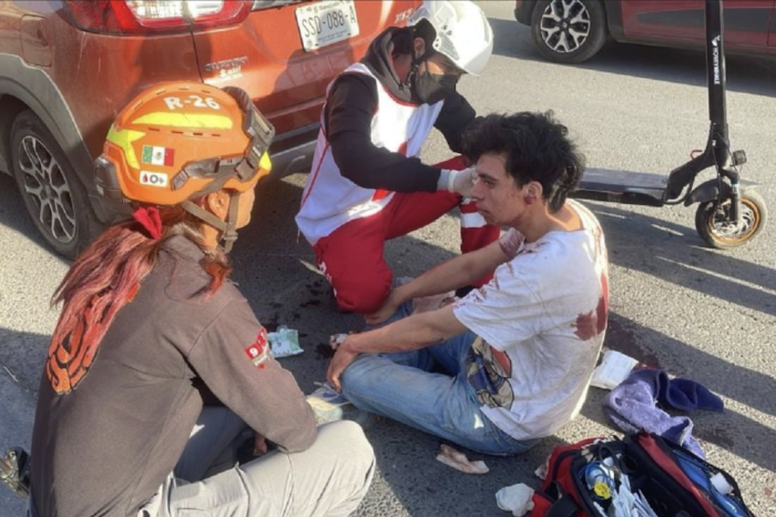 Joven sufre lesiones tras impactar su scooter